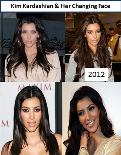Kim Kardashian Goes Wild With Plastic Surgery Since Dumping Kris Humphries (Photos)