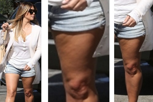 Kim Kardashian Cellulite Ass 105