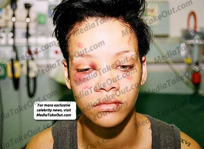rihanna face beat up. of rihannas face abused