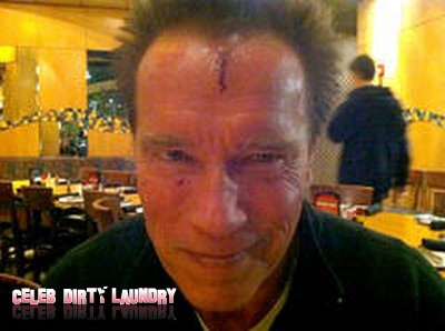 Arnold Schwarzenegger Head Gash Injury While Filming 'The Last Stand'