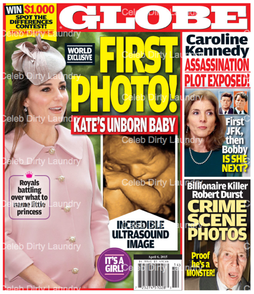 Kate Middleton Unborn Baby Girl First Ultrasound Photo: Royal Family Battle Over Princess Daughter's Name - GLOBE