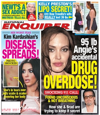 Kim Kardashian's Disease Spreads, Her Biggest Fear!