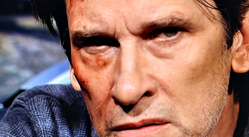 The Young and the Restless Spoilers: Evil Matt Returns, Head Injury Revives Worst Impulses?