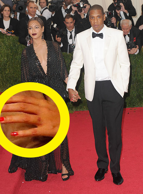 Beyonce Removes Ring Finger Tattoo: Erases Jay-Z Eternal Love (PHOTO) |  Celeb Dirty Laundry