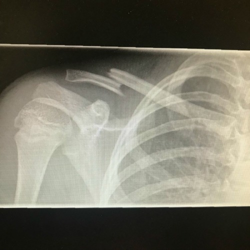 General Hospital Spoilers: GH Star Suffers Scary Injury – Reveals Terrible Ordeal, Asks Fans for Help