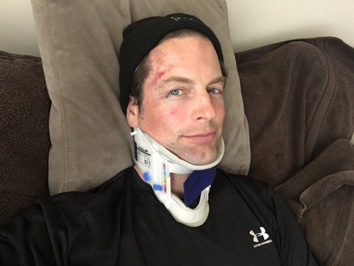 The Young and the Restless Spoilers: Michael Muhney Terrible Facial Injury – Find Out Why Former Y&R Star’s Suffering