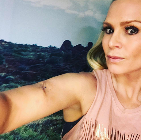 Tamra Judge Reveals Skin Cancer Fears And Mystery Mole: Uses Health Scare For ‘Real Housewives of Orange County' PR Gains?